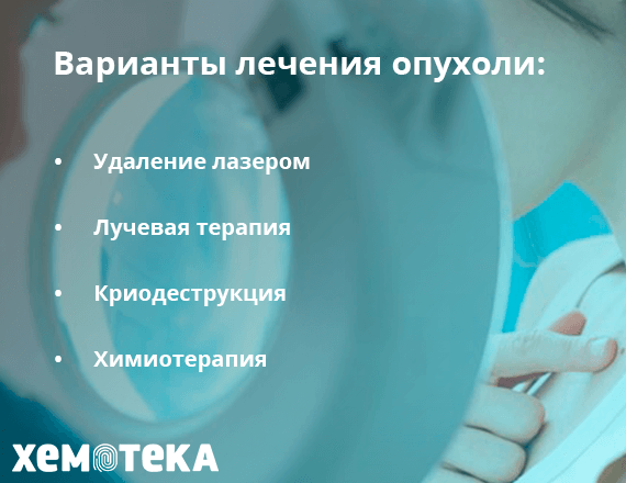 Варианты лечения опухоли Варианты лечения опухоли