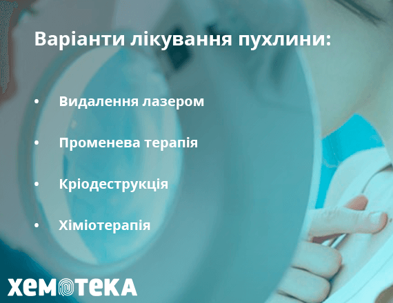 Варіанти лікування пухлини Варіанти лікування пухлини