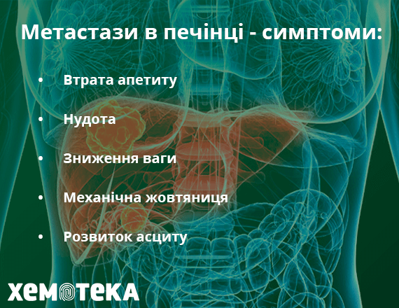 метастази у печінці метастази у печінці