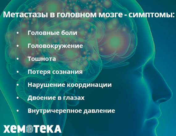 метастазы в головном мозге метастазы в головном мозге