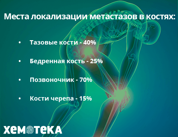 метастазы в костях метастазы в костях