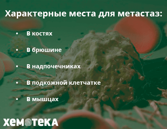 типичные места метастазирования типичные места метастазирования