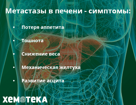 метастазы в печени метастазы в печени