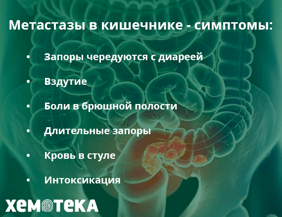 метастазы в кишечнике метастазы в кишечнике