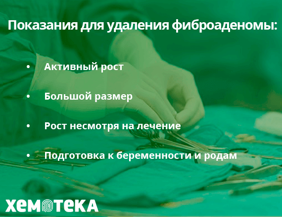 Удалить фиброаденому Удалить фиброаденому
