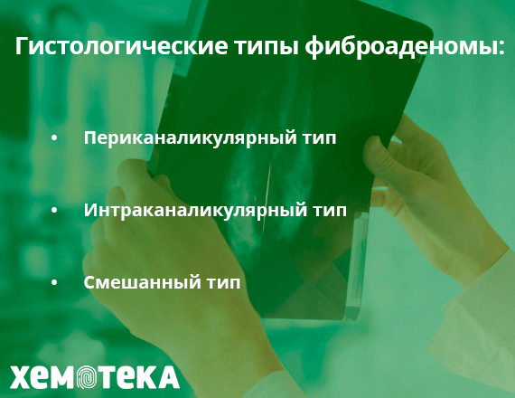 Гистологические типы фиброаденомы Гистологические типы фиброаденомы
