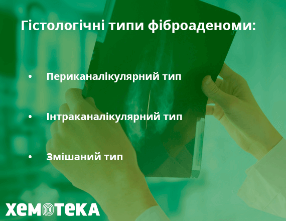 Гістологічні типи фіброаденоми Гістологічні типи фіброаденоми