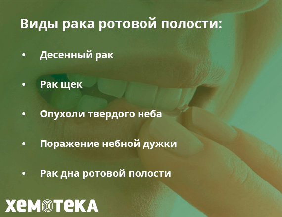 Виды рака Виды рака