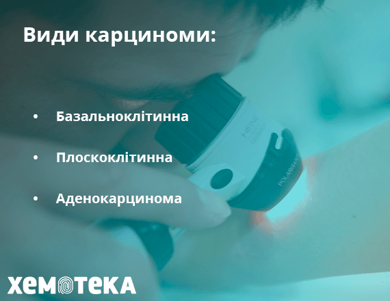 Види карциноми Види карциноми