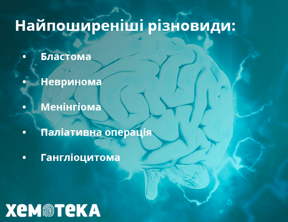 Різновиди ПГМ Різновиди ПГМ