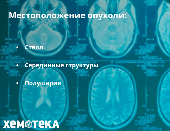 опухоль ГМ опухоль ГМ