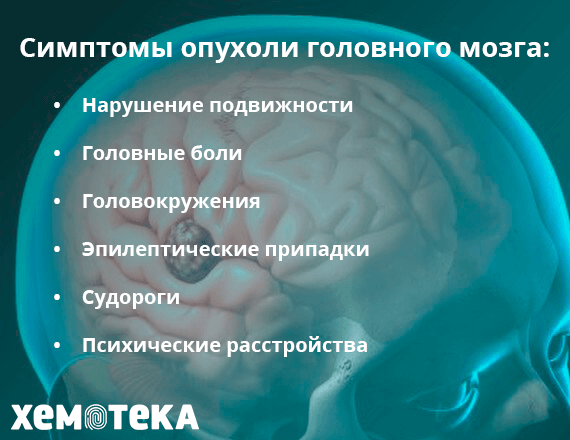 симптомы опухолей головного мозга симптомы опухолей головного мозга