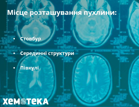 пухлини ГМ пухлини ГМ