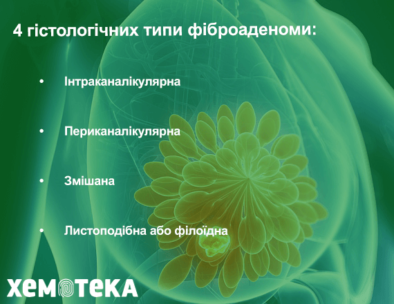 типи фіброаденоми типи фіброаденоми