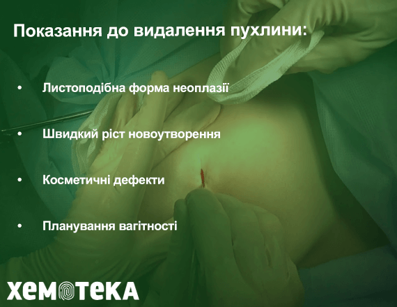 Методи лікування Методи лікування