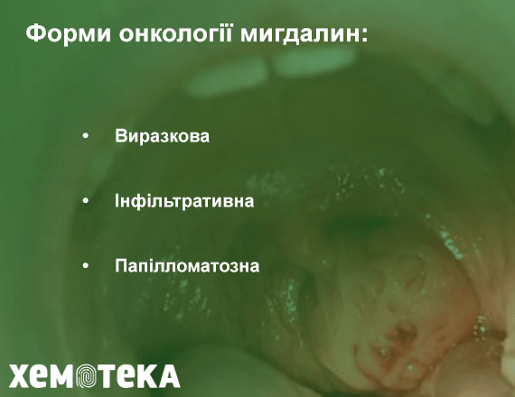 форми онкології форми онкології