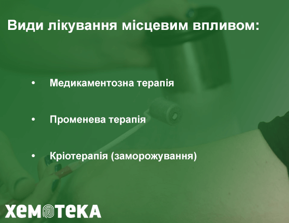 місцевий вплив місцевий вплив
