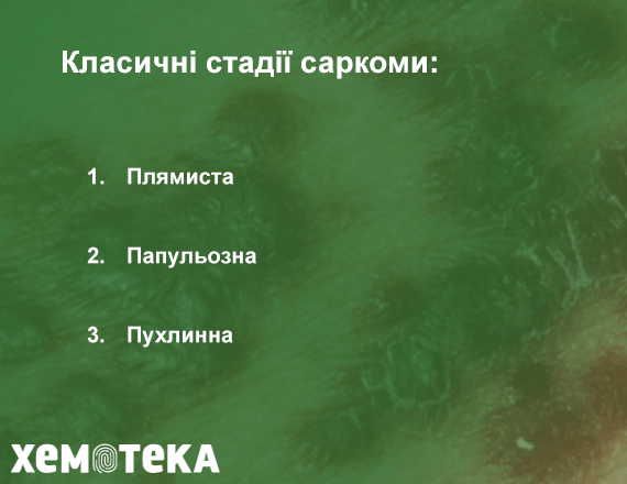 стадії саркоми стадії саркоми