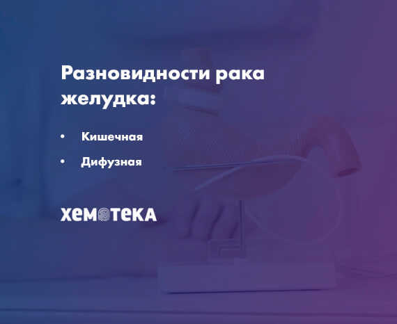 разновидности рака желудка разновидности рака желудка