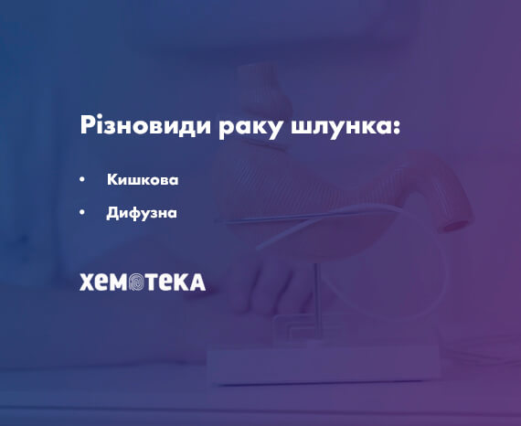 різновиди раку шлунку різновиди раку шлунку